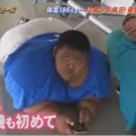 １０歳で体重１８６ｋｇの超巨漢な少年が日本で精密検査を受けた結果